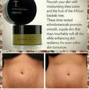 bl cream for stretch marks